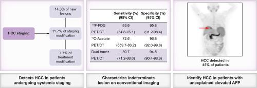 Dual-tracer PET/CT in the management of hepatocellular carcinoma