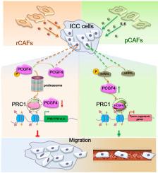 Modulating PCGF4/BMI1 Stability Is an Efficient Metastasis-Regulatory Strategy Used by Distinct Subtypes of Cancer-Associated Fibroblasts in Intrahepatic Cholangiocarcinoma