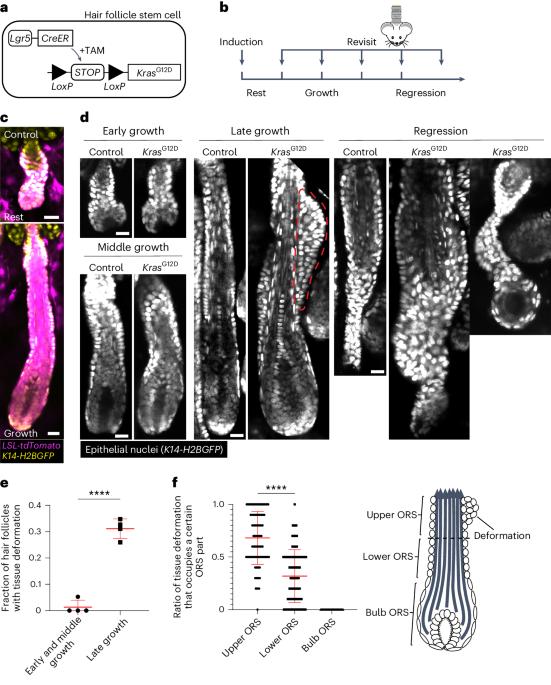 Oncogenic Kras induces spatiotemporally specific tissue deformation through converting pulsatile into sustained ERK activation