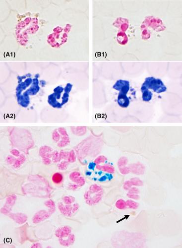 Characterization of blue-green blood leukocyte inclusions and accompanying clinical, hematologic, and serum biochemical changes in dogs