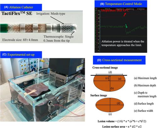 An optimized approach for increasing lesion size in temperature-controled setting using a catheter with a surface thermocouple and efficient irrigation