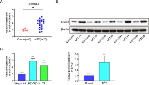 LncRNA ZFAS1 promotes invasion of medullary thyroid carcinoma by enhancing EPAS1 expression via miR-214-3p/UCHL1 axis