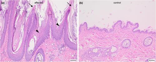 Heterozygous deletion of the NSDHL gene in an Appenzeller Mountain Dog with verrucous epidermal keratinocytic nevi