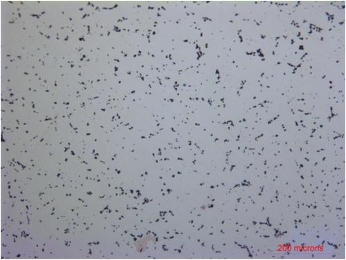 Impact of magnet shape and material on the magnet stress