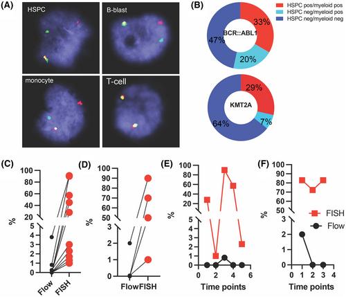 Multilineage involvement in KMT2A-rearranged B acute lymphoblastic leukaemia: cell-of-origin, biology, and clinical implications