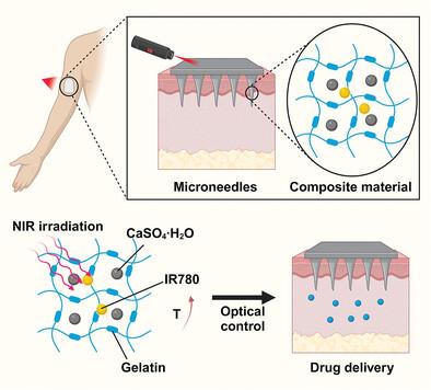 Near-Infrared Triggered Biodegradable Microneedle Patch for Controlled Macromolecule Drug Release