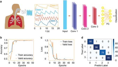 Deep Learning-Assisted Sensitive 3C-SiC Sensor for Long-Term Monitoring of Physical Respiration