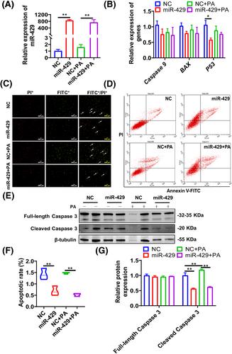 miR-429 inhibits palmitic acid-induced apoptosis of porcine subcutaneous preadipocytes by targeting Sox5