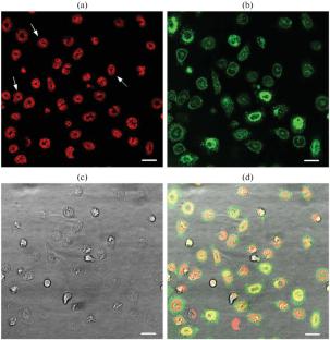 The Effect of Nicotine Acetylcholine Receptor Ligands on the Adhesive Properties of Murine Bone Marrow Granulocytes in Inflammation