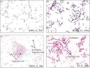 In Vitro Probiotic Attributes of Potential Probiotic Bacillus Strain Isolated from Indigenous Fermented Soybean Foods of Northeast, India