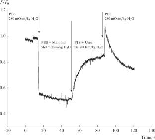 Corneal Endothelial Cell Volume Regulation Disorders in Keratoconus