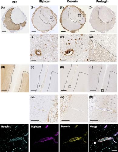 A role for vessel-associated extracellular matrix proteins in multiple sclerosis pathology