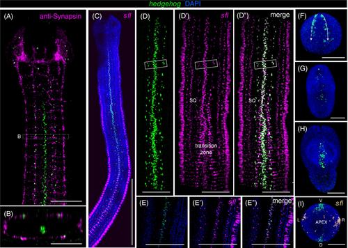 Muscular remodeling and anteroposterior patterning during tapeworm segmentation