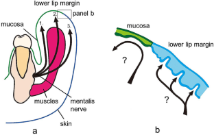 Mentalis nerve branches supplying the lower lip revisited: a study of human fetuses and donated elderly cadavers