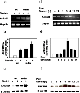 ANKRD1 expression is aberrantly upregulated in the mdm mouse model of muscular dystrophy and induced by stretch through NFκB