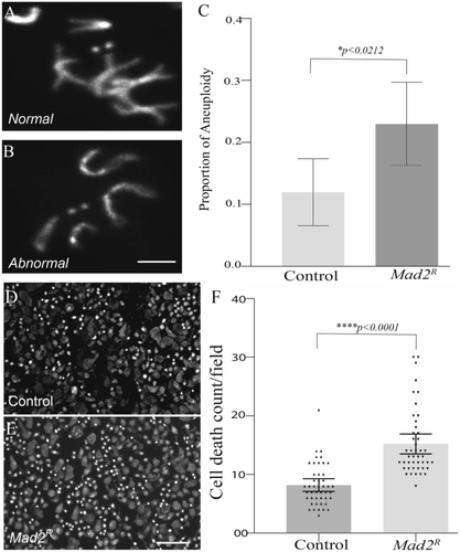 Aneuploidy is Linked to Neurological Phenotypes Through Oxidative Stress