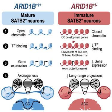 ARID1B controls transcriptional programs of axon projection in an organoid model of the human corpus callosum