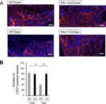 Plasminogen activator inhibitor-1 is involved in glucocorticoid-induced decreases in angiogenesis during bone repair in mice.