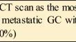 International consensus on the management of metastatic gastric cancer: step by step in the foggy landscape : Bertinoro Workshop, November 2022.