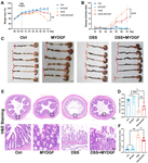 Myeloid-derived growth factor ameliorates dextran sodium sulfate-induced colitis by regulating macrophage polarization.