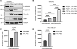 TGFß1 Stimulates Lymphatic Endothelial Cells to Produce IL7 and IL15, Which Act as Chemotactic Factors for Breast Cancer Cells with Mesenchymal Properties.