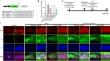 Adeno-associated Virus-mediated Ezh2 Knockdown Reduced the Increment of Newborn Neurons Induced by Forebrain Ischemia in Gerbil Dentate Gyrus.