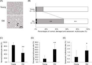 Analysis of the relationship between age-related erythrocyte dysfunction and fatigue.