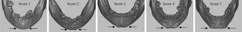 What we see is what we touch? Sex estimation on the skull in virtual anthropology.