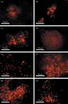 Effect of Plasma Treatment of Biomedical Scaffolds on Neuronal Cell Adhesion