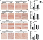 Correction: GP120 and tenofovir alafenamide alter cannabinoid receptor 1 expression in hippocampus of mice.