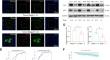 Author Correction: Porphyromonas gingivalis promotes the progression of oral squamous cell carcinoma by stimulating the release of neutrophil extracellular traps in the tumor immune microenvironment.