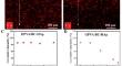 Hydroxyapatite Gradient Poly (Vinyl Alcohol)/Bacteria Cellulose Bone Scaffold via Buoyancy-Driven Gradient Method