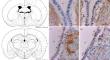 Synaptophysin Expression by Supraependymal Structures of Rat Brain