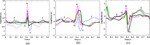 A Novel R-Peak Detection Model and SE-ResNet-Based PVC Recognition for 12-Lead ECGs