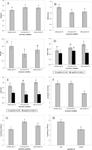 Effects of the extrusion conditions, the addition of oil and the food matrix on the physical and sensory characteristics of pre-extrusion flavored products