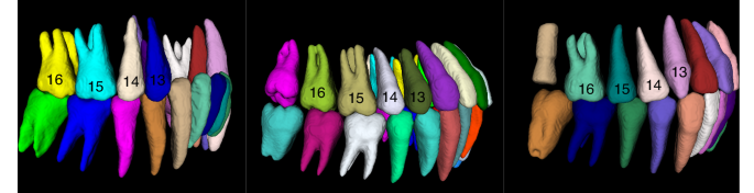 Fully automatic AI segmentation of oral surgery-related tissues based on cone beam computed tomography images