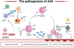 Kidney Failure in Pauci-immune Crescentic Glomerulonephritis: Rationale for Immunosuppression to Improve Kidney Outcome.