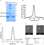 19F-NMR studies of the impact of different detergents and nanodiscs on the A2A adenosine receptor