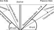 Parametric Study for the Behavior of Blocks Anchor Embedded in Sand at Various Conditions