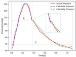 The Effect of Coronary Atherosclerosis on Radial Pressure Wave: A Cross-Sectional Observational Clinical Study