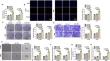 Cancer-associated fibroblasts-derived exosomal METTL3 promotes the proliferation, invasion, stemness and glutaminolysis in non-small cell lung cancer cells by eliciting SLC7A5 m6A modification.