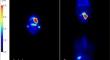 Maximum standardized uptake value in <sup>11</sup>C-methionine positron emission tomography may predict the prognosis of patients with oral squamous cell carcinoma.