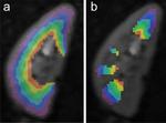 Spatial profiling of in vivo diffusion-weighted MRI parameters in the healthy human kidney.