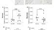 Differential expression of small bowel TGFβ1 and TGFβ3 characterizes intestinal strictures in patients with fibrostenotic Crohn's disease.