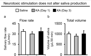 Neurotoxic stimulation alters prosaposin levels in the salivary systems of rats.