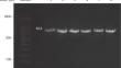 LZTFL1 rs17713054 Polymorphism as an Indicator Allele for COVID-19 Severity