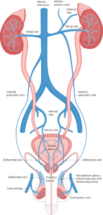 Elevated periprostatic androgens, sneaky testosterone and its implications