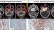 A head-to-head comparison of [<sup>68</sup>Ga]Ga-DOTATATE and [<sup>68</sup>Ga]Ga-FAPI PET/CT in patients with nasopharyngeal carcinoma: a single-center, prospective study.