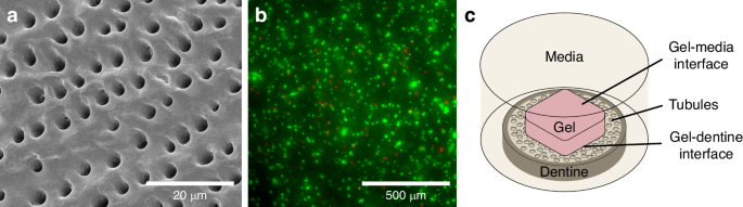 A 3D In-vitro model of the human dentine interface shows long-range osteoinduction from the dentine surface