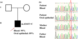 A novel pathogenic mitochondrial DNA variant m.4344T>C in tRNAGln causes developmental delay